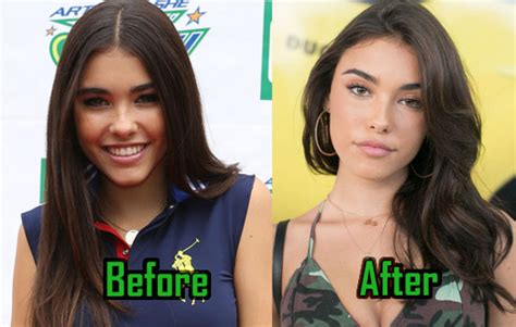 does madison beer have a boob job|People Think Madison Beer Had a Plastic Surgery,。